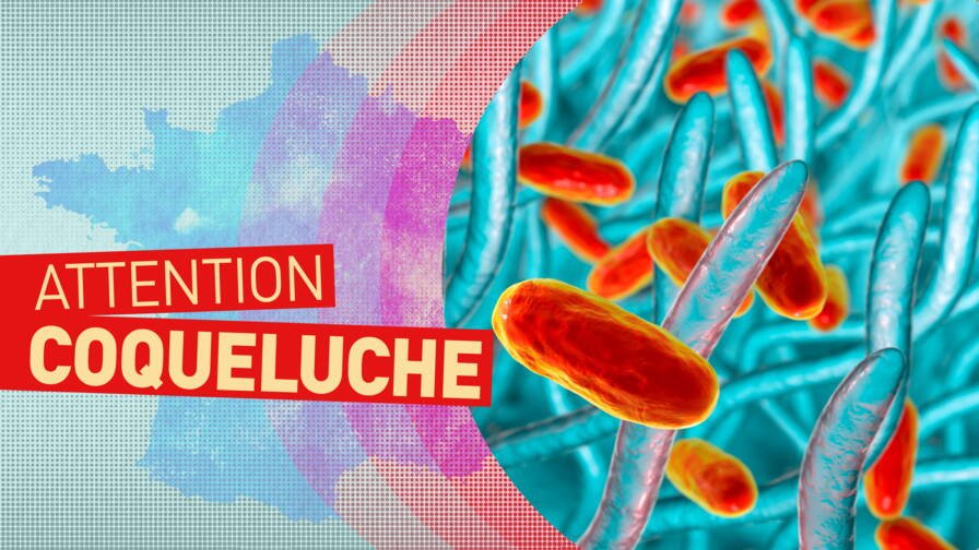 Allo docteur : La coqueluche